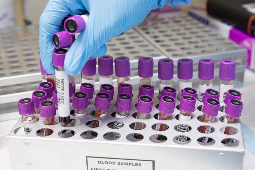 EJHF: Риск смерти от сердечной недостаточности можно выявить по анализу крови