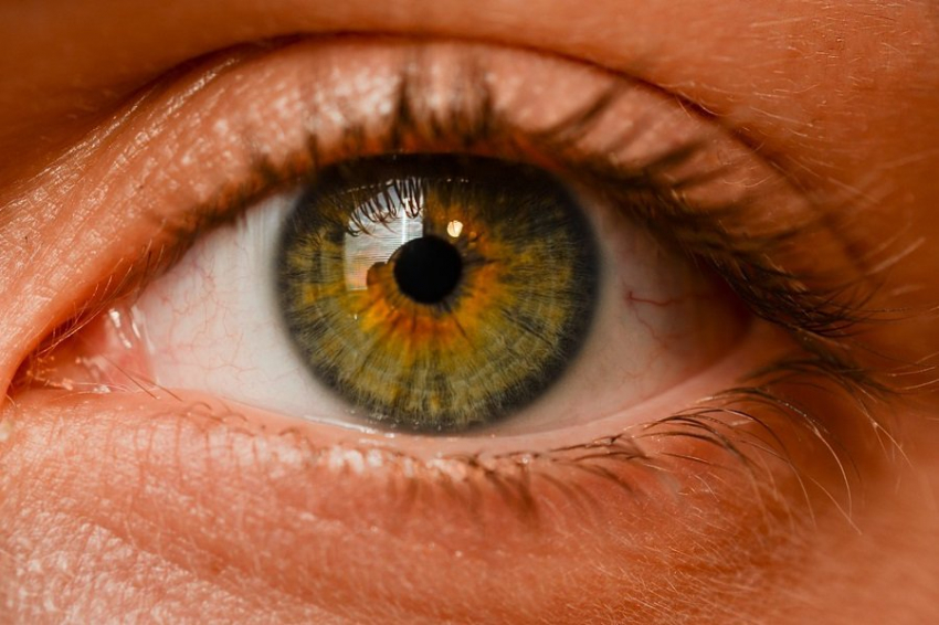 Стресс может усугубить проблемы со сухостью глаз