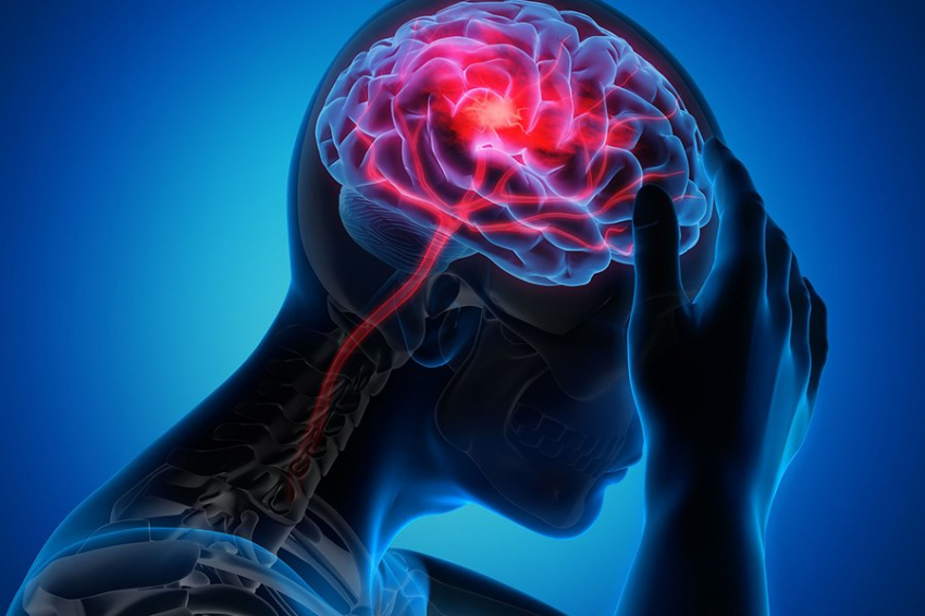 Риск инсульта увеличивается у людей с множественными травмами головы