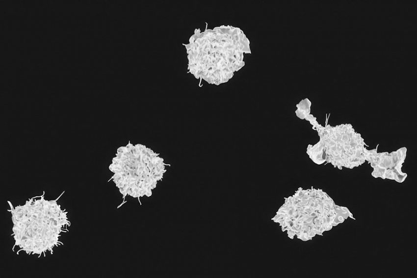 Макрофаги способствуют заживлению мышц, ведя себя как настенные клетки