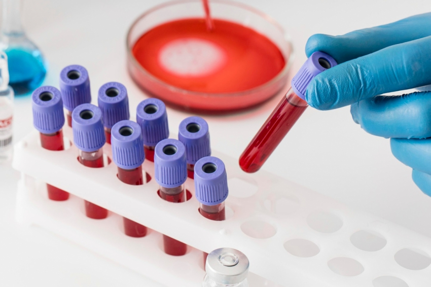 Врач Габорец рассекретил, какая группа крови считается самой лучшей