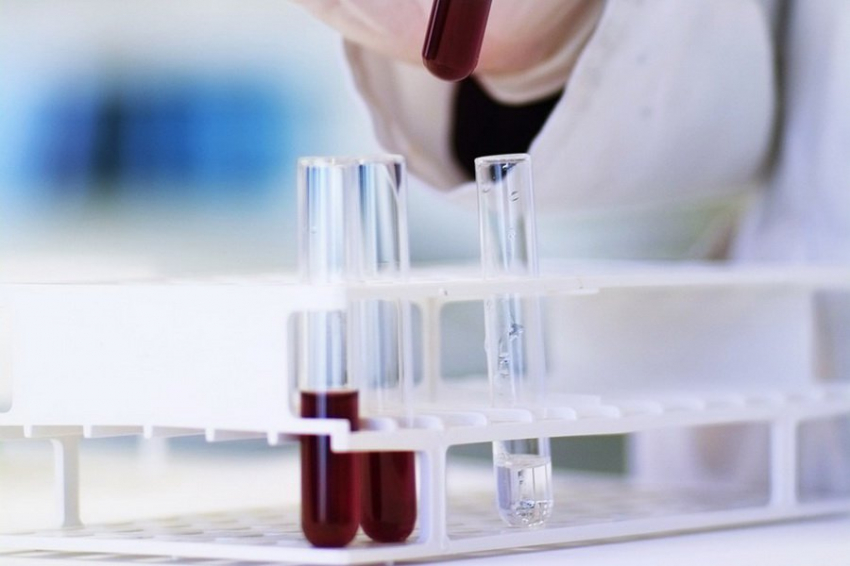 Исследователи из Нью-Йорка приблизились к созданию вакцины против ВИЧ