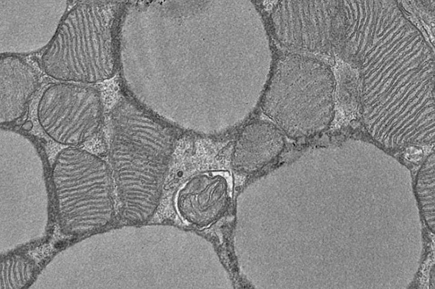 Бурый жир: как клетки генерируют тепло, сжигая калории