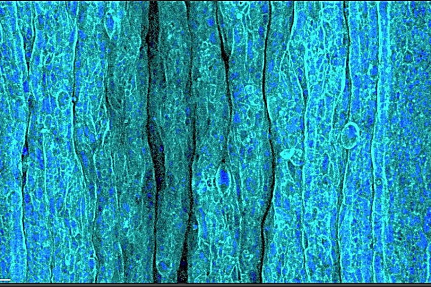 Ученые раскрыли механизмы образования морщин