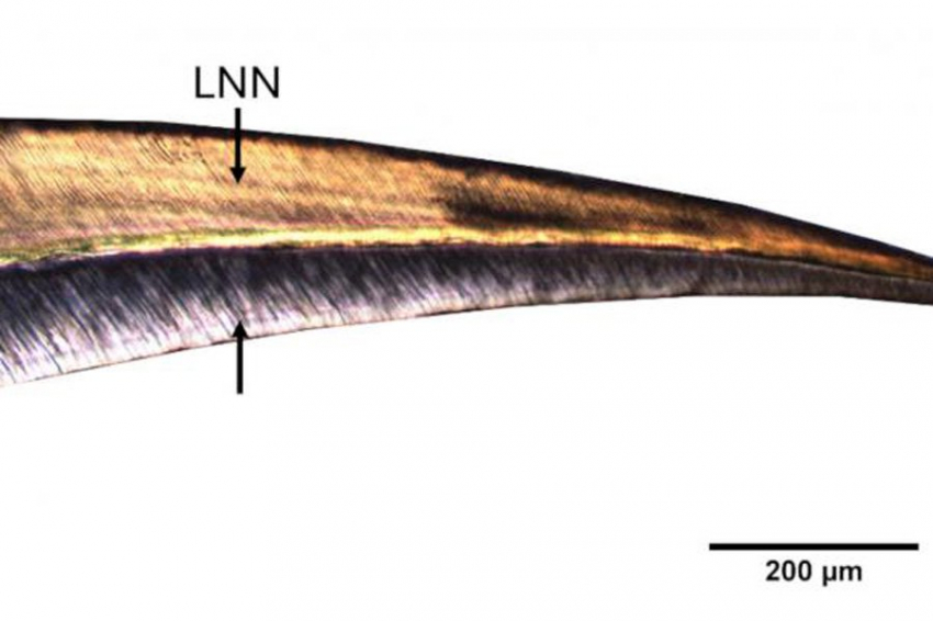 Древние зубы раскрывают причины детской смертности в Испании железного века
